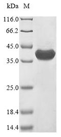 (Tris-Glycine gel) Discontinuous SDS-PAGE (reduced) with 5% enrichment gel and 15% separation gel.