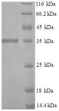 Recombinant Human Interferon alpha-1/13 (IFNA1) – Figure 1 of 1