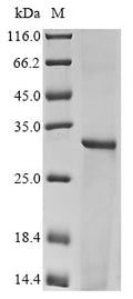 (Tris-Glycine gel) Discontinuous SDS-PAGE (reduced) with 5% enrichment gel and 15% separation gel.