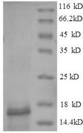 Recombinant Gadus morhua subsp. callarias Parvalbumin beta – Figure 1 of 1