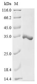(Tris-Glycine gel) Discontinuous SDS-PAGE (reduced) with 5% enrichment gel and 15% separation gel.