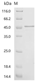 (Tris-Glycine gel) Discontinuous SDS-PAGE (reduced) with 5% enrichment gel and 15% separation gel.