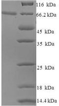 Recombinant Human papillomavirus type 16 Minor capsid protein L2 (L2) – Figure 1 of 1