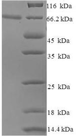 Recombinant Human papillomavirus type 16 Minor capsid protein L2 (L2) – Figure 1 of 1