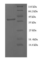 (Tris-Glycine gel) Discontinuous SDS-PAGE (reduced) with 5% enrichment gel and 15% separation gel.