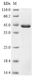 (Tris-Glycine gel) Discontinuous SDS-PAGE (reduced) with 5% enrichment gel and 15% separation gel.