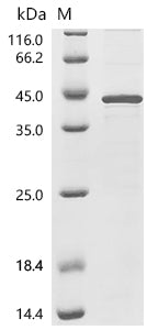 (Tris-Glycine gel) Discontinuous SDS-PAGE (reduced) with 5% enrichment gel and 15% separation gel.