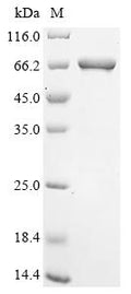 (Tris-Glycine gel) Discontinuous SDS-PAGE (reduced) with 5% enrichment gel and 15% separation gel.