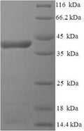 Recombinant Human respiratory syncytial virus A Major surface glycoprotein G (G), partial – Figure 1 of 1