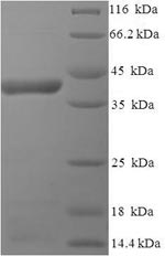 Recombinant Human respiratory syncytial virus A Major surface glycoprotein G (G), partial – Figure 1 of 1