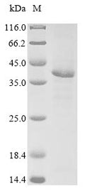 (Tris-Glycine gel) Discontinuous SDS-PAGE (reduced) with 5% enrichment gel and 15% separation gel.