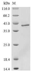 (Tris-Glycine gel) Discontinuous SDS-PAGE (reduced) with 5% enrichment gel and 15% separation gel.