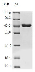 (Tris-Glycine gel) Discontinuous SDS-PAGE (reduced) with 5% enrichment gel and 15% separation gel.