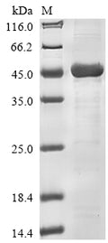 (Tris-Glycine gel) Discontinuous SDS-PAGE (reduced) with 5% enrichment gel and 15% separation gel.