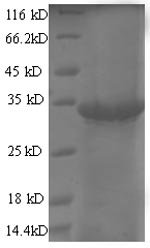 Recombinant Escherichia phage T7 Single-stranded DNA-binding protein (2.5) – Figure 1 of 1