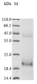 (Tris-Glycine gel) Discontinuous SDS-PAGE (reduced) with 5% enrichment gel and 15% separation gel.