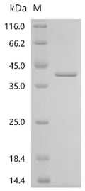 (Tris-Glycine gel) Discontinuous SDS-PAGE (reduced) with 5% enrichment gel and 15% separation gel.