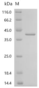 (Tris-Glycine gel) Discontinuous SDS-PAGE (reduced) with 5% enrichment gel and 15% separation gel.