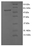 Recombinant Escherichia coli Modification methylase EcoRV (ecoRVM) – Figure 1 of 1
