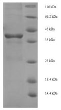 Recombinant Escherichia coli Tetracycline repressor protein class B from transposon Tn10 (tetR) – Figure 1 of 1