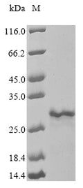 (Tris-Glycine gel) Discontinuous SDS-PAGE (reduced) with 5% enrichment gel and 15% separation gel.