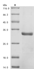 (Tris-Glycine gel) Discontinuous SDS-PAGE (reduced) with 5% enrichment gel and 15% separation gel.