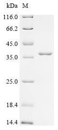 (Tris-Glycine gel) Discontinuous SDS-PAGE (reduced) with 5% enrichment gel and 15% separation gel.