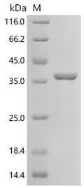 (Tris-Glycine gel) Discontinuous SDS-PAGE (reduced) with 5% enrichment gel and 15% separation gel.