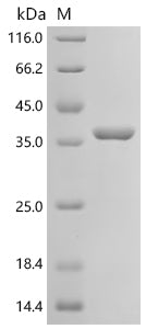 (Tris-Glycine gel) Discontinuous SDS-PAGE (reduced) with 5% enrichment gel and 15% separation gel.