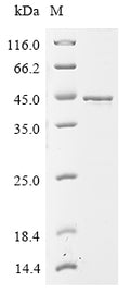 (Tris-Glycine gel) Discontinuous SDS-PAGE (reduced) with 5% enrichment gel and 15% separation gel.