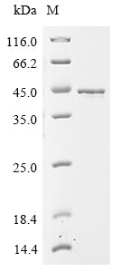 (Tris-Glycine gel) Discontinuous SDS-PAGE (reduced) with 5% enrichment gel and 15% separation gel.