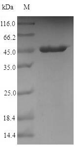 (Tris-Glycine gel) Discontinuous SDS-PAGE (reduced) with 5% enrichment gel and 15% separation gel.