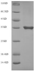 Recombinant Coptis japonica S-norcoclaurine synthase 2 (PR10A) – Figure 1 of 1