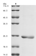 (Tris-Glycine gel) Discontinuous SDS-PAGE (reduced) with 5% enrichment gel and 15% separation gel.