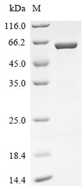Recombinant Bat coronavirus HKU5 Nucleoprotein (N) – Figure 1 of 1