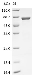 Recombinant Bat coronavirus HKU5 Nucleoprotein (N) – Figure 1 of 1