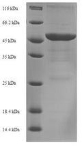 Recombinant Acinetobacter baumannii Outer membrane protein Omp38 (omp38) – Figure 1 of 1