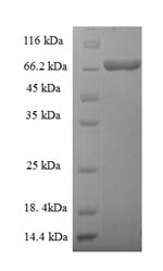 Recombinant Yersinia pestis 60 kDa chaperonin (groL) – Figure 1 of 1