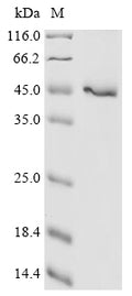 (Tris-Glycine gel) Discontinuous SDS-PAGE (reduced) with 5% enrichment gel and 15% separation gel.