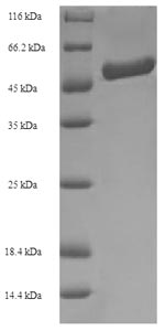 Recombinant Bradyrhizobium sp. Formamidase (amiF) – Figure 1 of 1