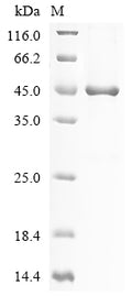 (Tris-Glycine gel) Discontinuous SDS-PAGE (reduced) with 5% enrichment gel and 15% separation gel.