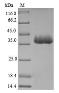(Tris-Glycine gel) Discontinuous SDS-PAGE (reduced) with 5% enrichment gel and 15% separation gel.