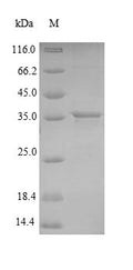 (Tris-Glycine gel) Discontinuous SDS-PAGE (reduced) with 5% enrichment gel and 15% separation gel.