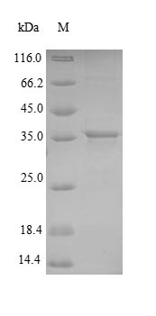 (Tris-Glycine gel) Discontinuous SDS-PAGE (reduced) with 5% enrichment gel and 15% separation gel.