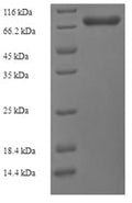 Recombinant Bacteroides vulgatus Alpha-1,3-galactosidase B (glaB1) – Figure 1 of 1