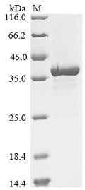 (Tris-Glycine gel) Discontinuous SDS-PAGE (reduced) with 5% enrichment gel and 15% separation gel.