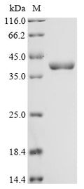 (Tris-Glycine gel) Discontinuous SDS-PAGE (reduced) with 5% enrichment gel and 15% separation gel.