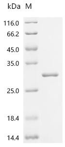 (Tris-Glycine gel) Discontinuous SDS-PAGE (reduced) with 5% enrichment gel and 15% separation gel.