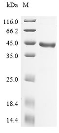 (Tris-Glycine gel) Discontinuous SDS-PAGE (reduced) with 5% enrichment gel and 15% separation gel.
