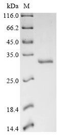 (Tris-Glycine gel) Discontinuous SDS-PAGE (reduced) with 5% enrichment gel and 15% separation gel.